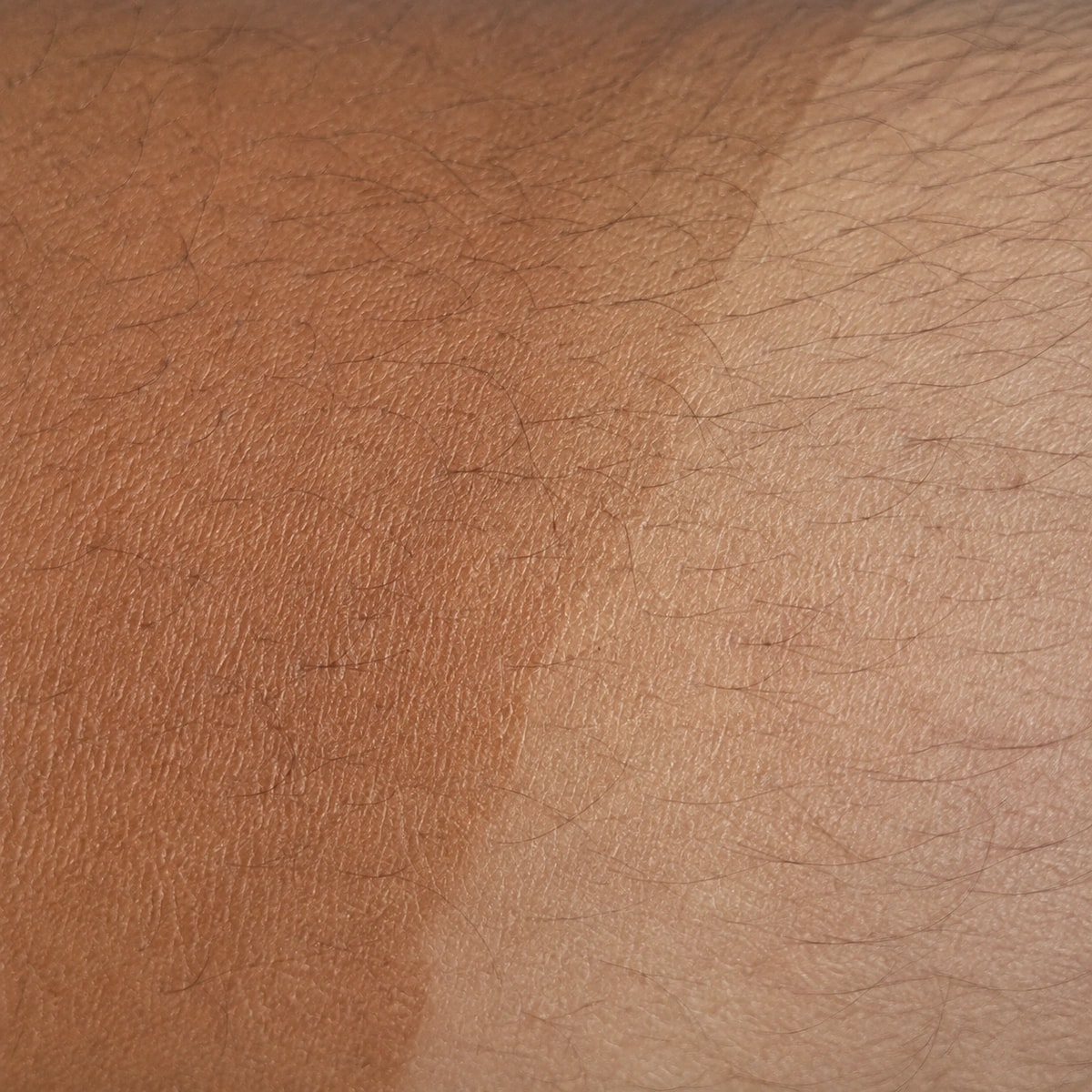 Close-up of a tan boundary on forearm skin